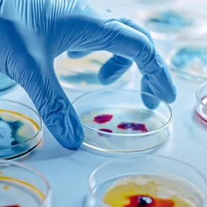 Imagen de portada para Curso online Curso Microbiología