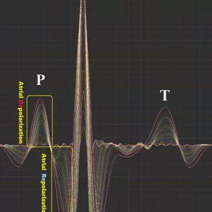 Imagen de portada para Ebook Arritmias Cardíacas: Guía Rápida de Diagnóstico y Abordaje Terapéutico