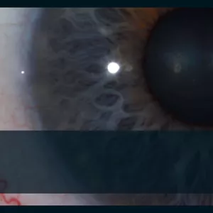 Imagem de capa para o Curso online Esclerologia - Básica