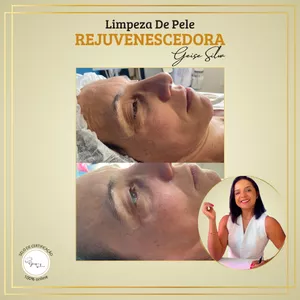 Imagem do curso Limpeza de Pele Rejuvenescedora