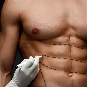 Imagem de capa para o Curso online Curso EAD de Definição Abdominal 
