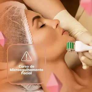 Imagem de capa para o Curso online Tudo sobre Microagulhamento Facial: Ciência, Técnica e Resultados