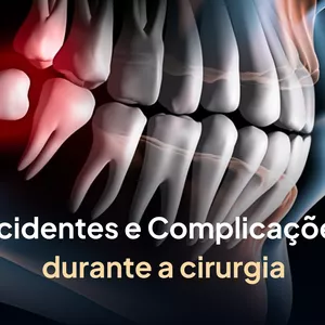 Imagem de capa para o Curso online Aulão: Acidentes e Complicações em Cirurgia