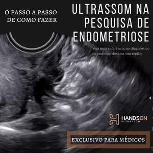 Imagem do curso CURSO DE ULTRASSOM NA PESQUISA DE ENDOMETRIOSE