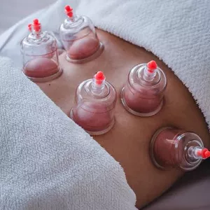 Imagem do curso Curso Ventosaterapia, Liberação Miofascial