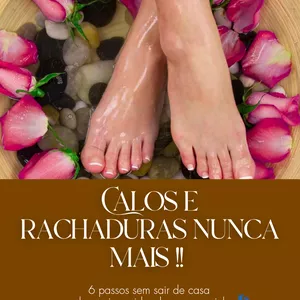 Imagem de capa para o Ebook Calos e rachaduras nunca mais!!
