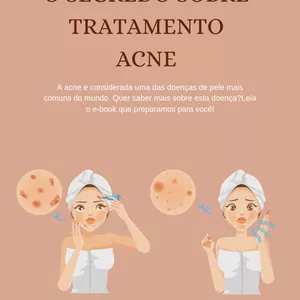 Imagem de capa para o Ebook tratamento para acne