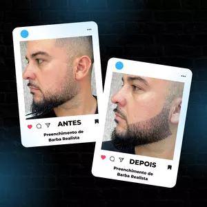 Imagem de capa para o Ebook Método PBR - Procedimento