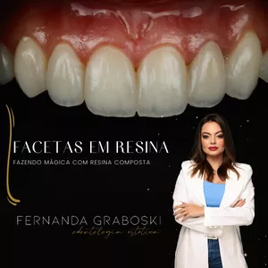 Imagem de capa para o Curso online Facetas em Resina Composta 