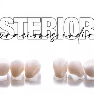 Imagem de capa para o Ebook Guía para Preparaciones de Restauraciones Indirectas Posteriores (Desde Table Top hasta Corona Total)