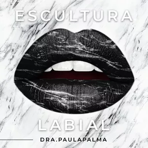 Imagem de capa para o Curso online Curso Online Preenchimento Labial e Rinomodelação 