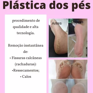 Imagem de capa para o Ebook Plastica dos pés- Passo a Passo