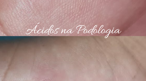 Podologia com ácidos