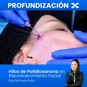 Imagen de portada para Curso online Entrenamiento Hilos de Polidioxanona en Rejuvenecimiento Facial
