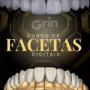 Imagem de capa para o Curso online Curso de Facetas Digitais no Exo 