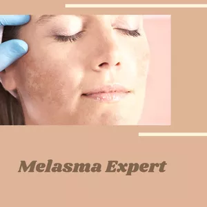 Imagem de capa para o Curso online Melasma Expert