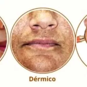 Imagem de capa para o Ebook Melasma Cuide em Casa