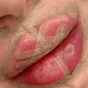 Imagem de capa para o Curso online Strip Lips